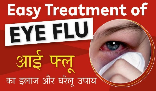 Eye Flu Thik Kaise Kare